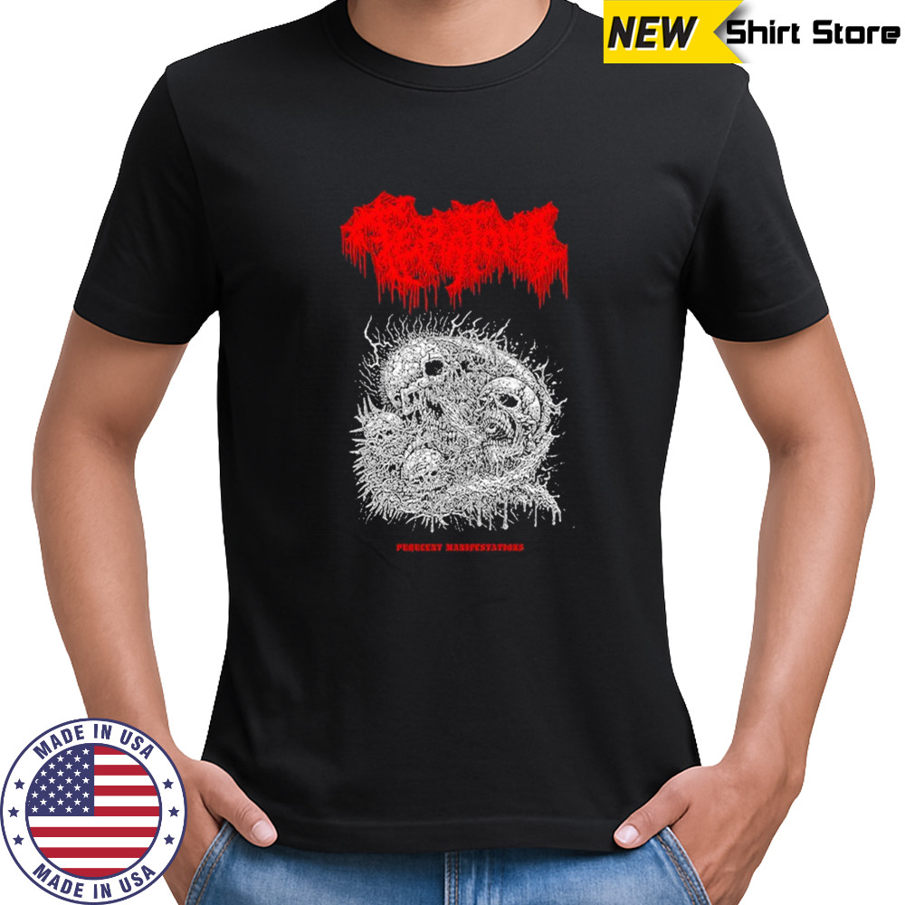 Teratoma Manifestations T-shirt